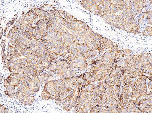 Recombinant E-Cadherin/CDH1/E-cad/CD324 Monoclonal Antibody (AGEL5340)