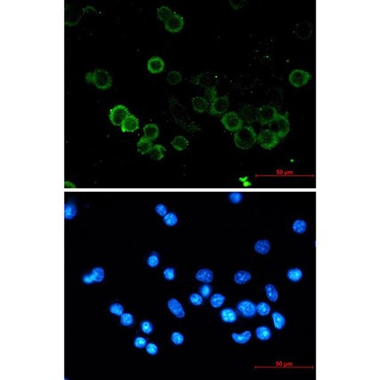 Recombinant E-Cadherin/CDH1/E-cad/CD324 Monoclonal Antibody (AGEL5340)
