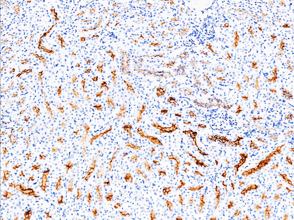 Recombinant ACE2 Monoclonal Antibody (AGEL5342)