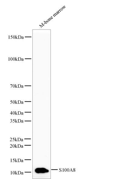 Recombinant S100A8 Monoclonal Antibody (AGEL5349)