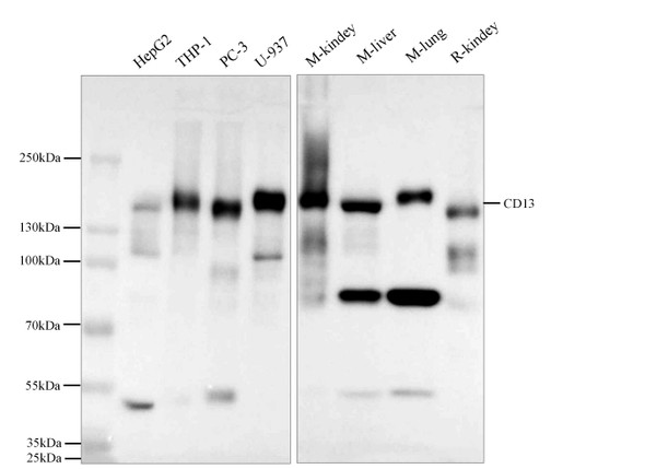 Recombinant CD13/ANPEP Monoclonal Antibody (AGEL5355)