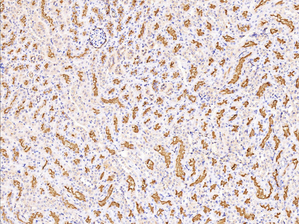 Recombinant CD13/ANPEP Monoclonal Antibody (AGEL5355)