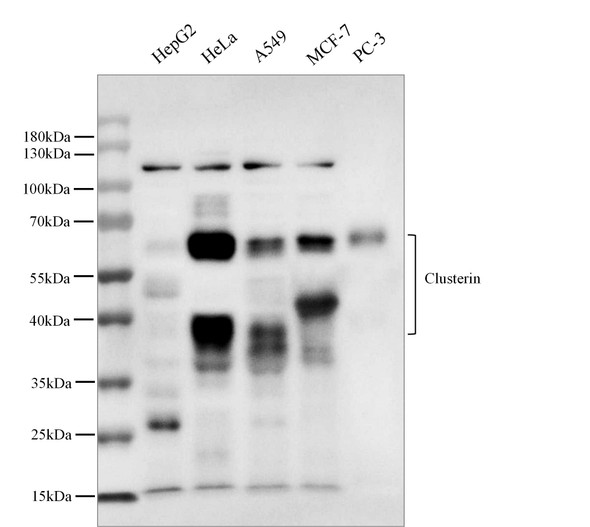 Recombinant Clusterin/Apolipoprotein J/Apo-J Monoclonal Antibody (AGEL5356)
