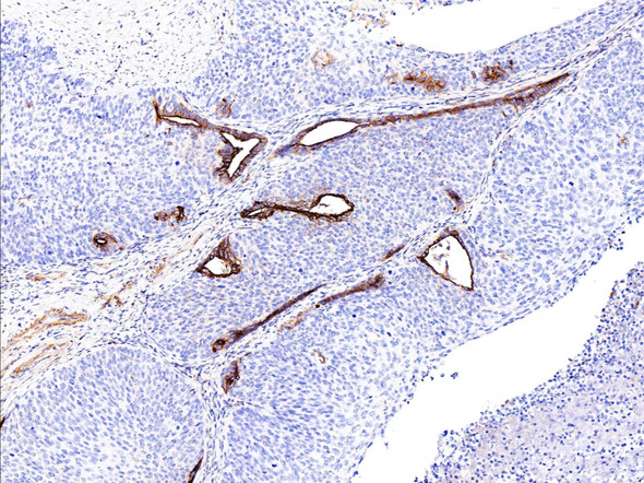 Recombinant Clusterin/Apolipoprotein J/Apo-J Monoclonal Antibody (AGEL5356)
