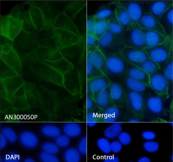 Recombinant IGF1R/CD221 Monoclonal Antibody (AGEL5359)