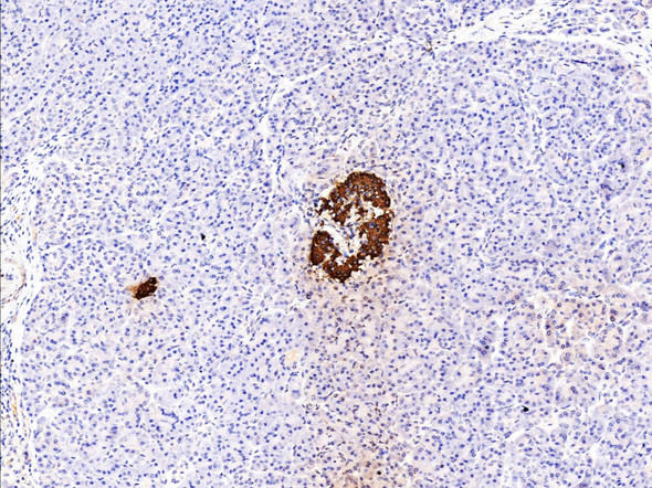 Recombinant Insulin Monoclonal Antibody (AGEL5361)