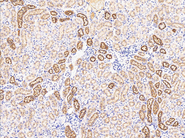 Recombinant NPC2 Monoclonal Antibody (AGEL5363)