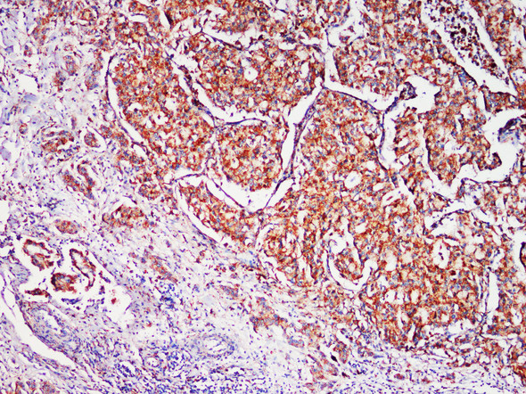 Recombinant LAMP1/CD107a Monoclonal Antibody (AGEL5365)