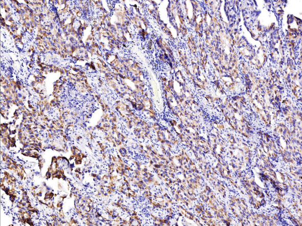 Recombinant IGFBP7 Monoclonal Antibody (AGEL5370)