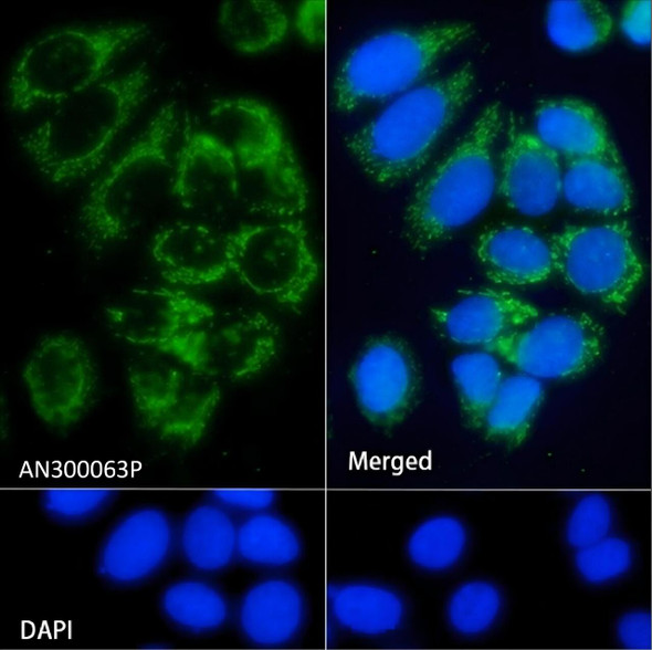 Recombinant IGFBP7 Monoclonal Antibody (AGEL5370)