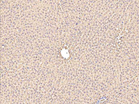 Recombinant ALDH7A1 Monoclonal Antibody (AGEL5373)