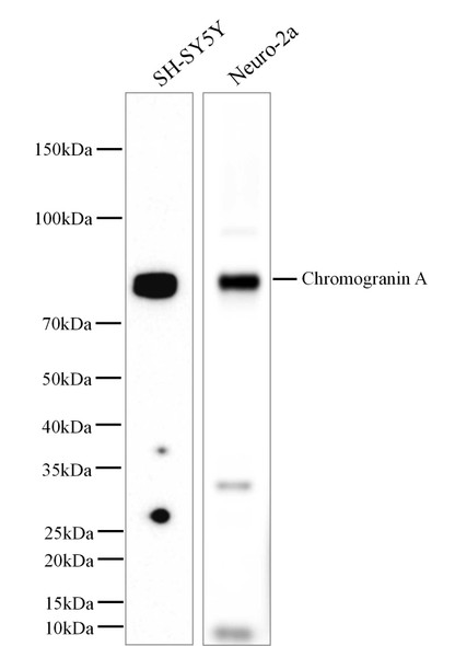 Recombinant Chromogranin A/CHGA/CGA Monoclonal Antibody (AGEL5375)