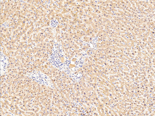 Recombinant FDPS/Farnesyl Diphosphate Synthase Monoclonal Antibody (AGEL5377)