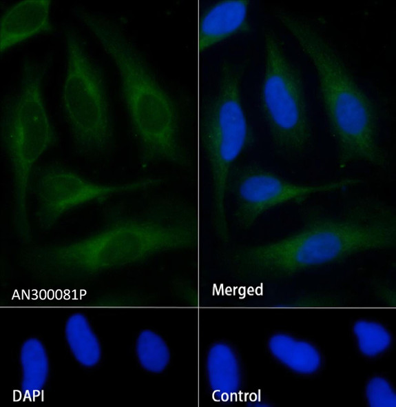 Recombinant S100A9 Monoclonal Antibody (AGEL5380)