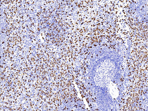 Recombinant S100A9 Monoclonal Antibody (AGEL5381)