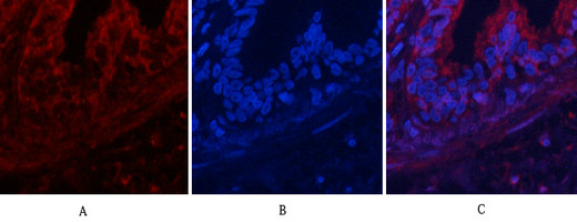 Recombinant Phospho-Akt (Thr308) Monoclonal Antibody (AGEL5383)
