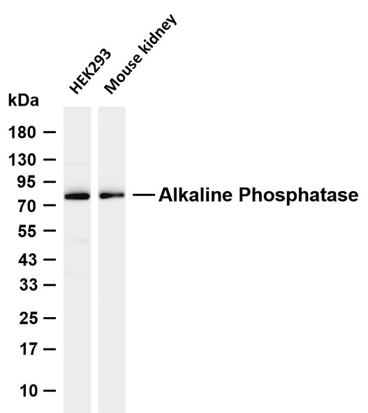 Recombinant Alkaline Phosphatase/ALPL Monoclonal Antibody (AGEL5386)
