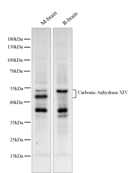 Recombinant Carbonic Anhydrase XIV/CA14 Monoclonal Antibody (AGEL5387)