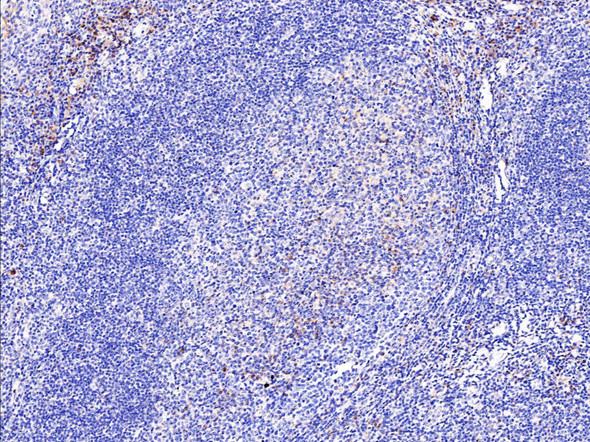 Recombinant 2B4/CD244 Monoclonal Antibody (AGEL5388)