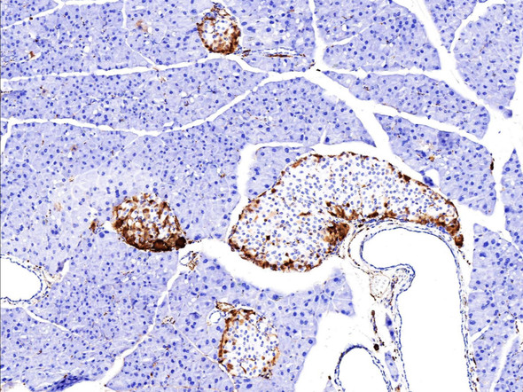 Recombinant UCHL1/PGP9.5 Monoclonal Antibody (AGEL5396)