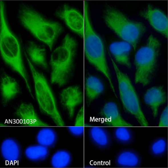 Recombinant Vimentin/VIM Monoclonal Antibody (AGEL5397)