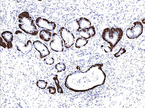 Recombinant Cytokeratin 5/KRT5 Monoclonal Antibody (AGEL5399)
