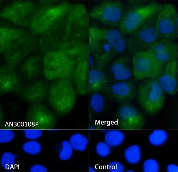 Recombinant Cytokeratin 5/KRT5 Monoclonal Antibody (AGEL5399)