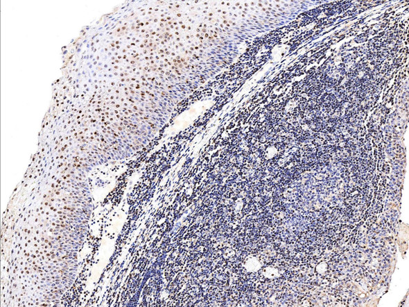 Recombinant Leukotriene A4 Hydrolase/LTA4H Monoclonal Antibody (AGEL5401)
