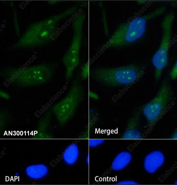 Recombinant S100A1 Monoclonal Antibody (AGEL5403)