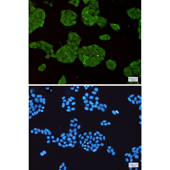 Recombinant STUB1 Monoclonal Antibody (AGEL5404)