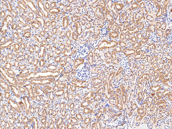 Recombinant AK2/Adenylate kinase 2 Monoclonal Antibody (AGEL5405)