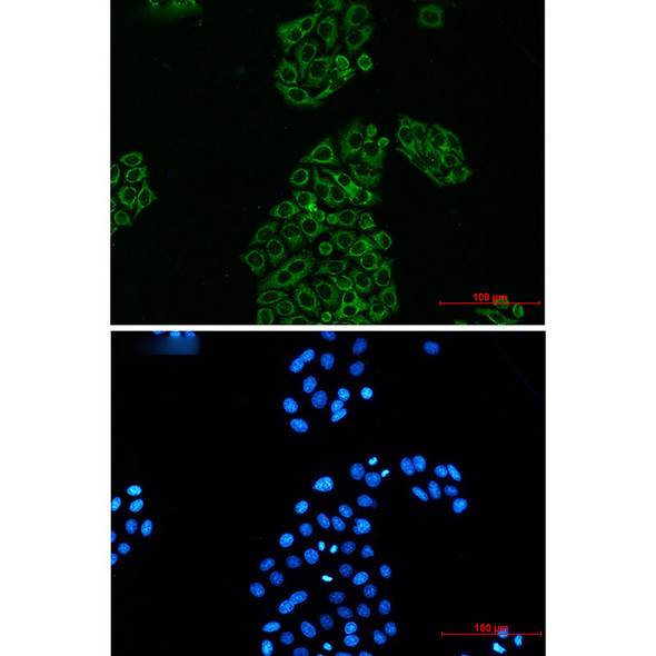 Recombinant AK2/Adenylate kinase 2 Monoclonal Antibody (AGEL5405)