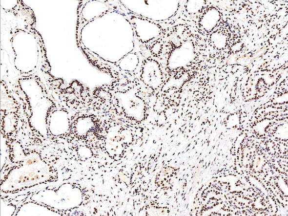 Recombinant Phospho-CREB (Ser133) Monoclonal Antibody (AGEL5406)