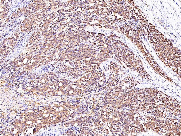 Recombinant GSTP1 Monoclonal Antibody (AGEL5408)