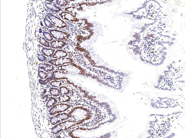 Recombinant MSH6/GTBP Monoclonal Antibody (AGEL5410)