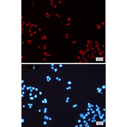 Recombinant MSH6/GTBP Monoclonal Antibody (AGEL5410)