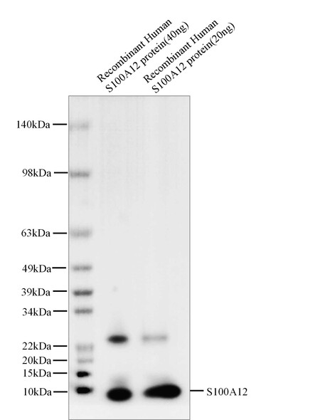 Recombinant S100A12 Monoclonal Antibody (AGEL5411)