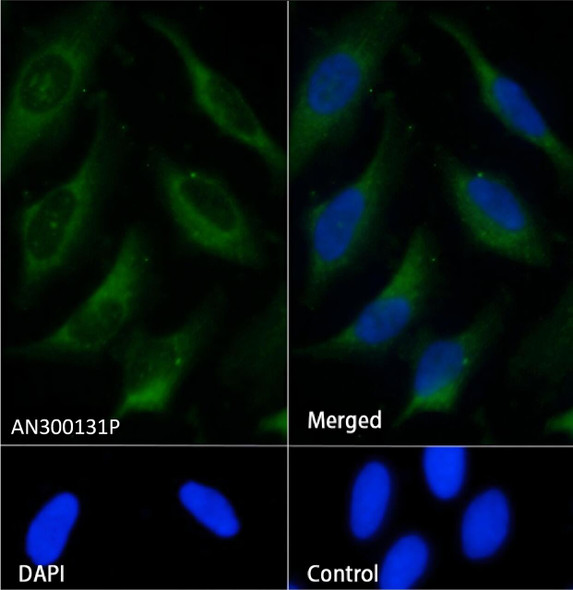 Recombinant S100A12 Monoclonal Antibody (AGEL5411)