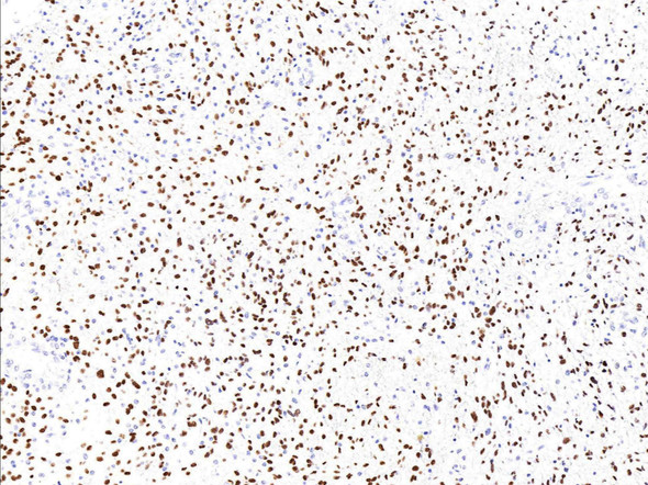 Recombinant Sox2 Monoclonal Antibody (AGEL5413)