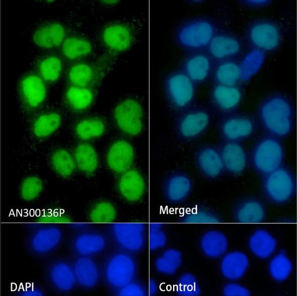 Recombinant p63(alpha) Monoclonal Antibody (AGEL5415)