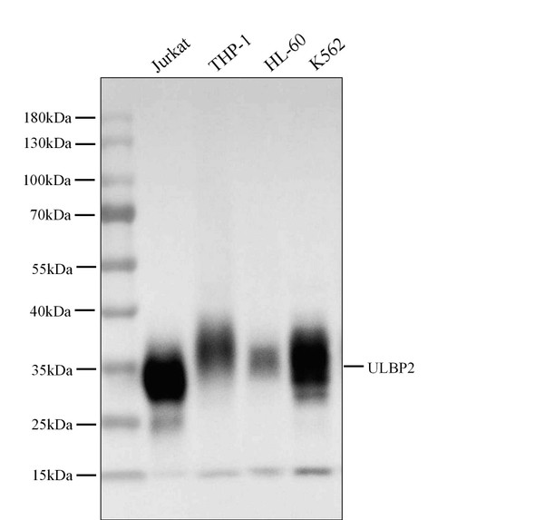 Recombinant ULBP2/N2DL-2 Monoclonal Antibody (AGEL5416)