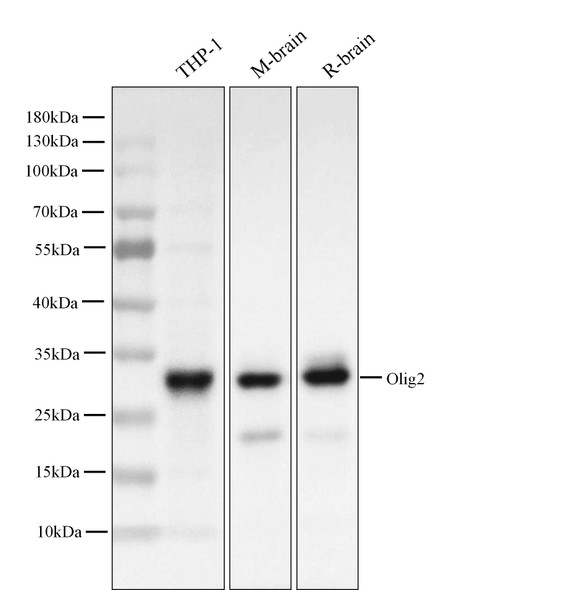 Recombinant Olig-2/Oligo2 Monoclonal Antibody (AGEL5418)