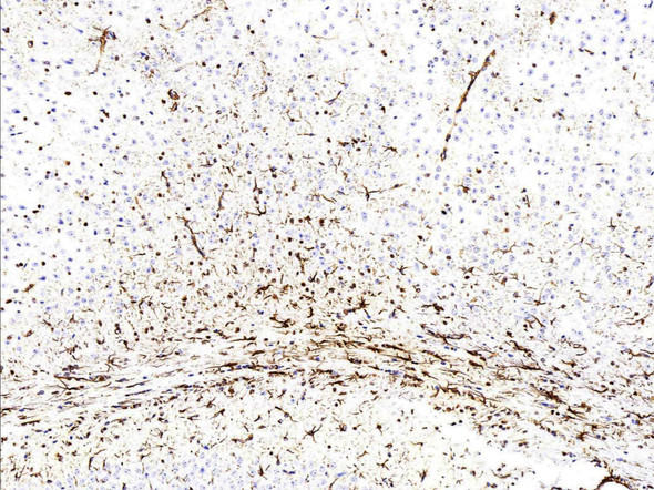 Recombinant Olig-2/Oligo2 Monoclonal Antibody (AGEL5418)