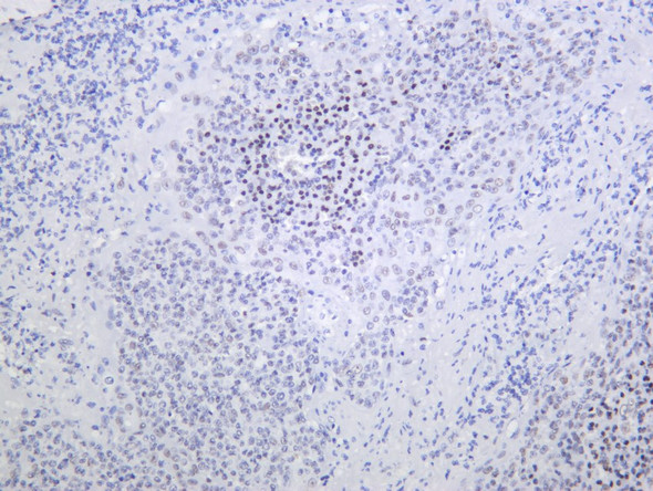 Recombinant BMI1 Monoclonal Antibody (AGEL5420)