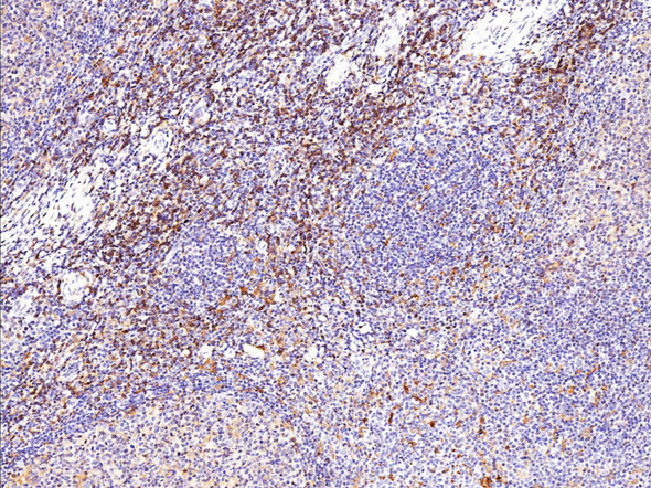 Recombinant Phospho-PKCα (Thr638) Monoclonal Antibody (AGEL5428)