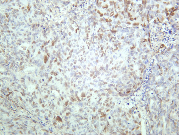 Recombinant Phospho-Chk2 (Thr68) Monoclonal Antibody (AGEL5429)