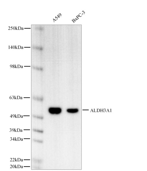 Recombinant ALDH3A1 Monoclonal Antibody (AGEL5434)