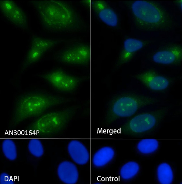 Recombinant PA28A/PSME1 Monoclonal Antibody (AGEL5435)