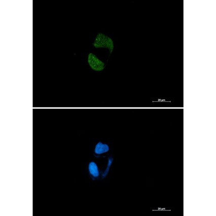 Recombinant AGO2/Argonaute 2/EIF2C2 Monoclonal Antibody (AGEL5436)