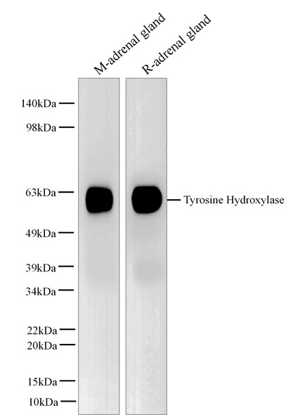 Recombinant TH/Tyrosine Hydroxylase Monoclonal Antibody (AGEL5437)